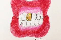 17_Teeth